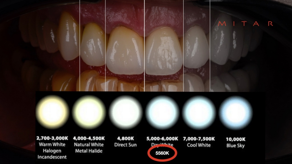 Dentalna fotografija 025